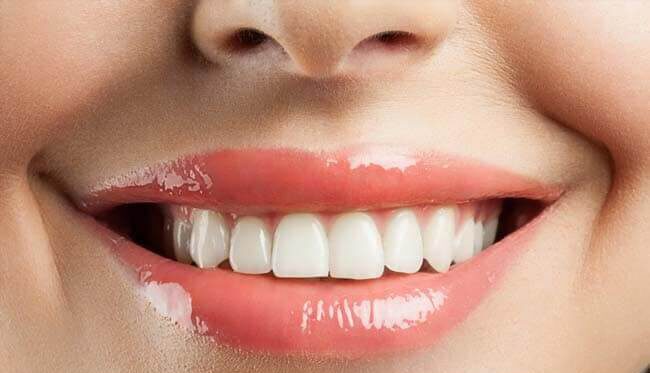 A fogkő eltávolítással megőrizheti fogai egészségét!
